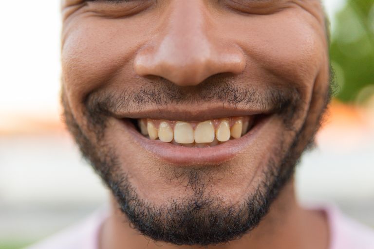 How To Remove Dark Stains From Teeth