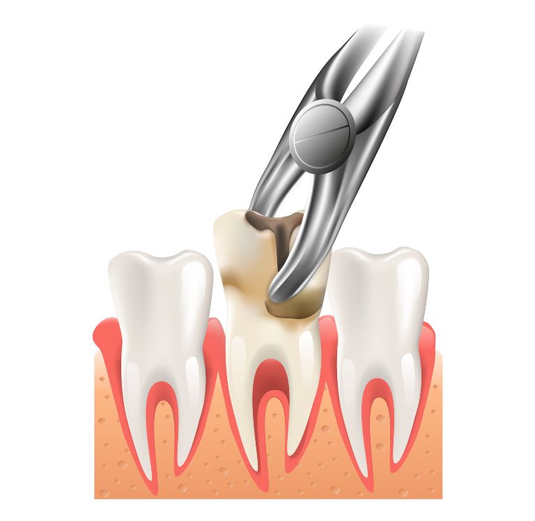 tooth nerve