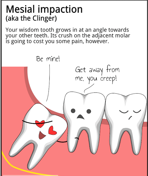 A cartoon of a tooth with the words mesothelioma.