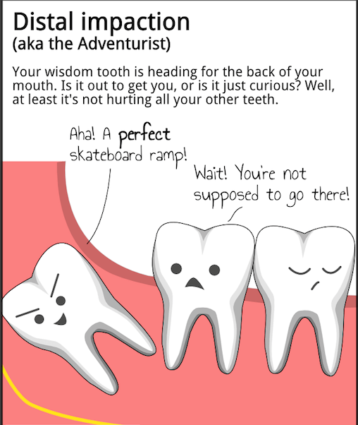 A diagram of a tooth with the words 'diastolic impact'.