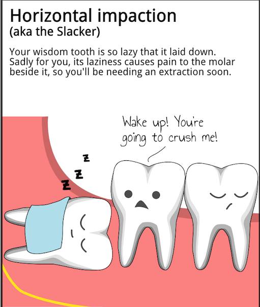A cartoon of a tooth with the words horizontal impact.
