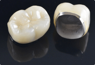 A tooth with a crown and a tooth with a crown.