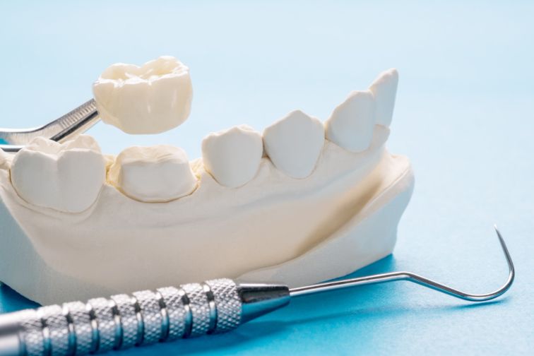 What Are Your Temporary Dental Filling Options? - Dental Aware Australia