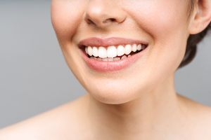 A woman smiles with her teeth whitened.