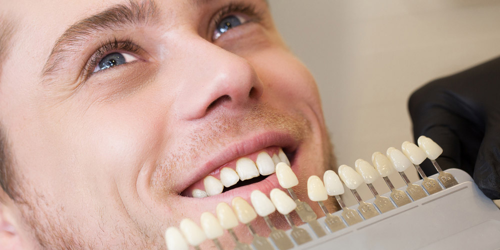 A man smiles as he gets his teeth cleaned.