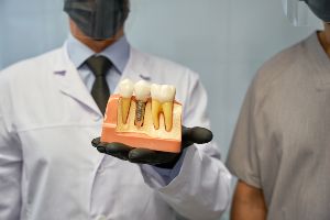 Two dentists holding a model of a tooth.