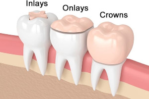 A diagram showing the different stages of a tooth.
