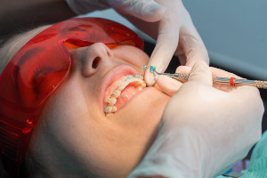 A woman is getting her teeth fixed in a dentist's office.