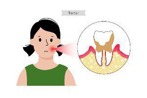 An illustration of a woman with a toothache.