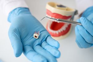 A dentist holding a model of a tooth.