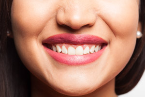 A close up of a woman's teeth.