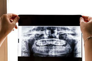 A woman is holding up an x - ray of her teeth.