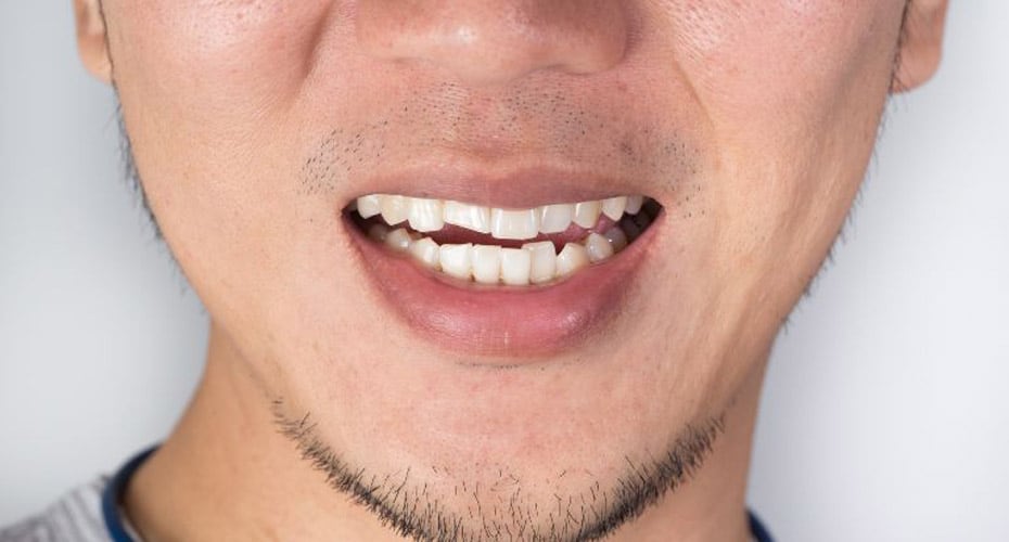 A close up of a man's mouth.